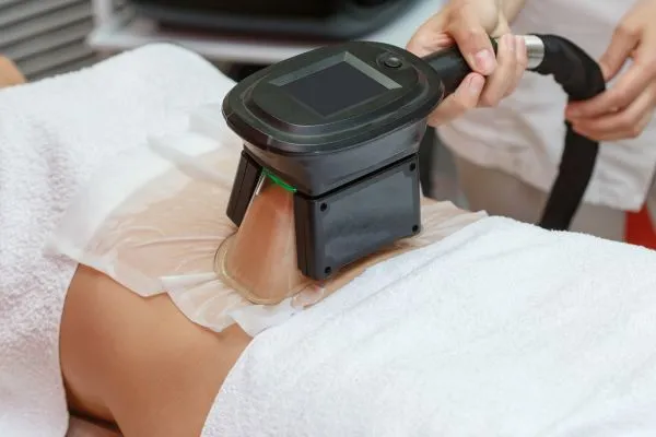 Image of person having fat freezing treatment to help weight gain Southampton