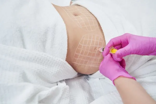 image of fat dissolving injections on love handles to help combat weight gain Southampton