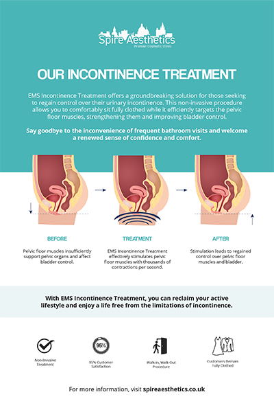 image of how urge incontinence Southampton treatment works