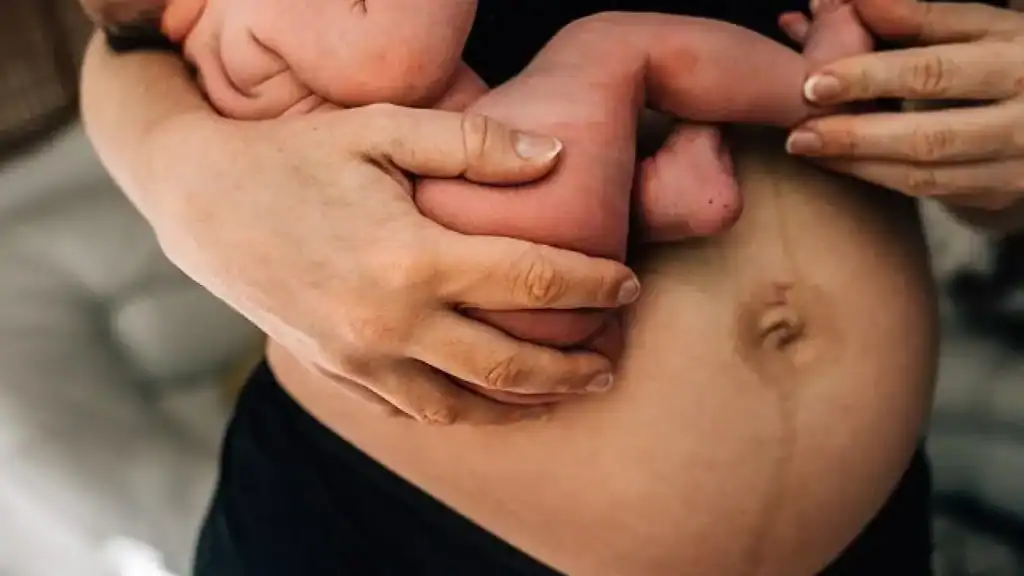 Why Is My Stomach Still Big After Pregnancy Southampton?